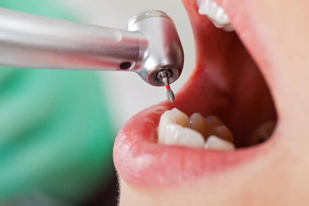 Best Emergency Gum Treatment in Zilwaukee, MI